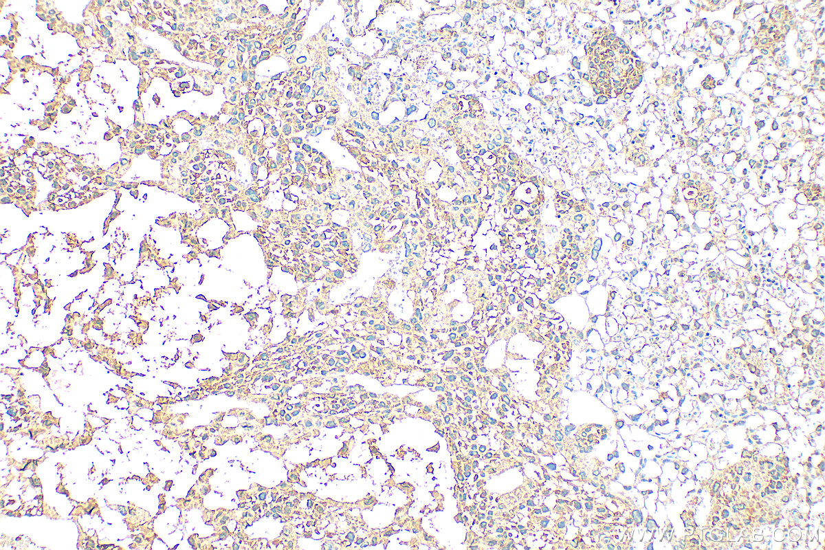 IHC staining of mouse placenta using 10642-1-AP IHC staining of mouse placenta using 10642-1-AP