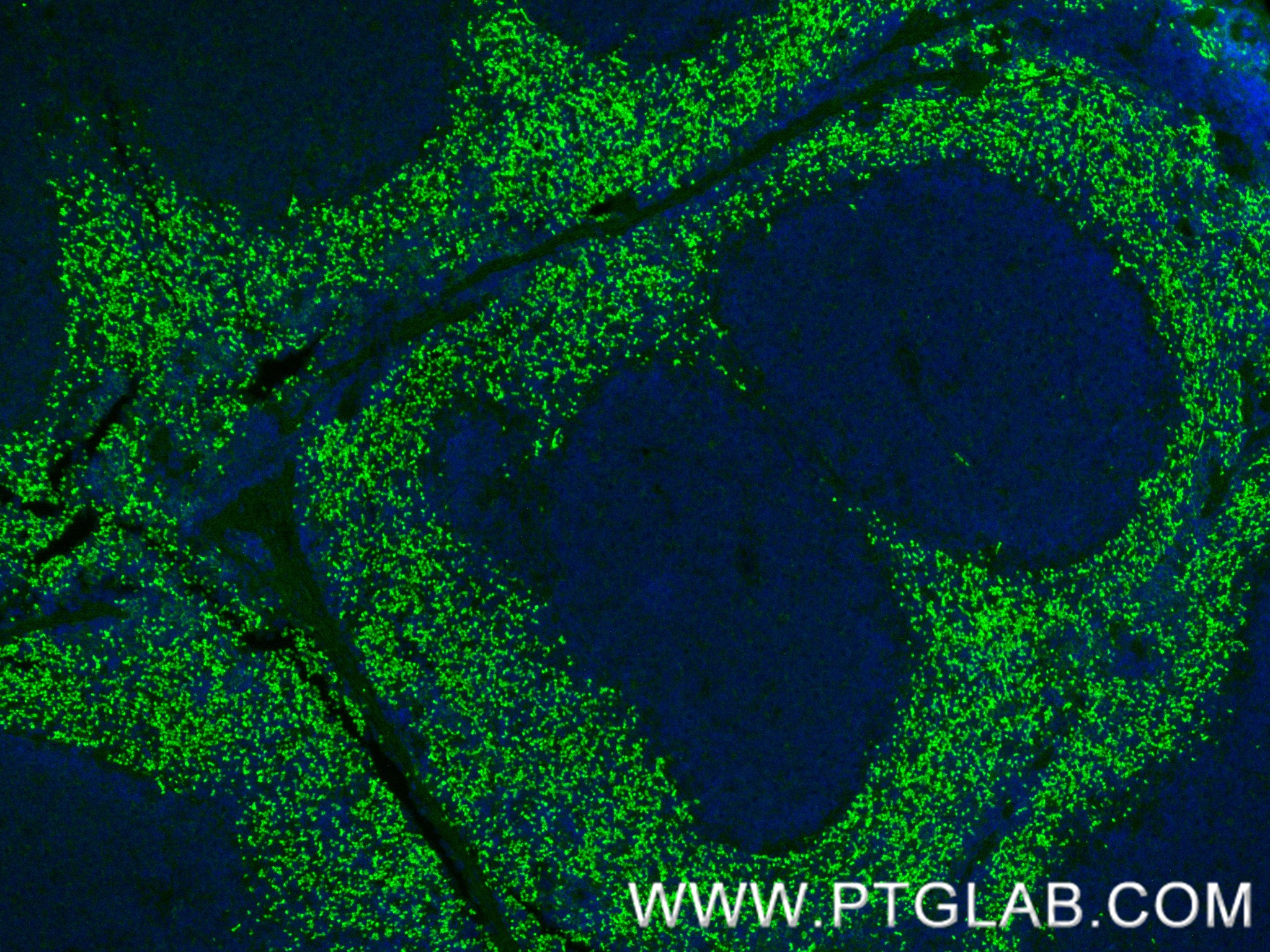 IF Staining of mouse spleen using 85610-4-RR