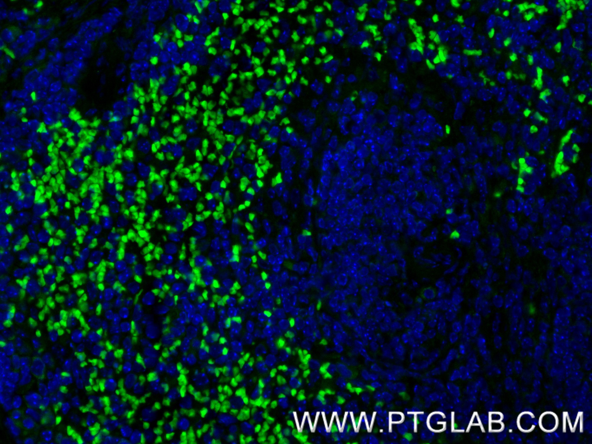 IF Staining of mouse spleen using 85610-4-RR