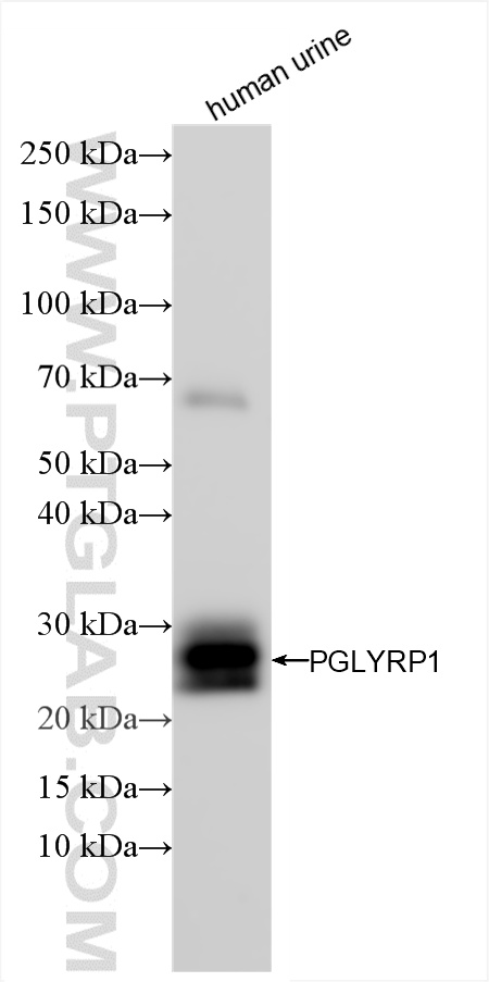 WB analysis of human urine using 85610-4-RR