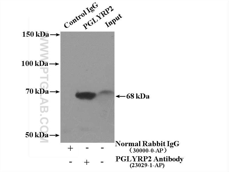 IP experiment of human plasma using 23029-1-AP (same clone as 23029-1-PBS)