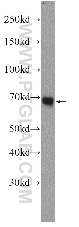 WB analysis of human plasma using 23029-1-AP (same clone as 23029-1-PBS)