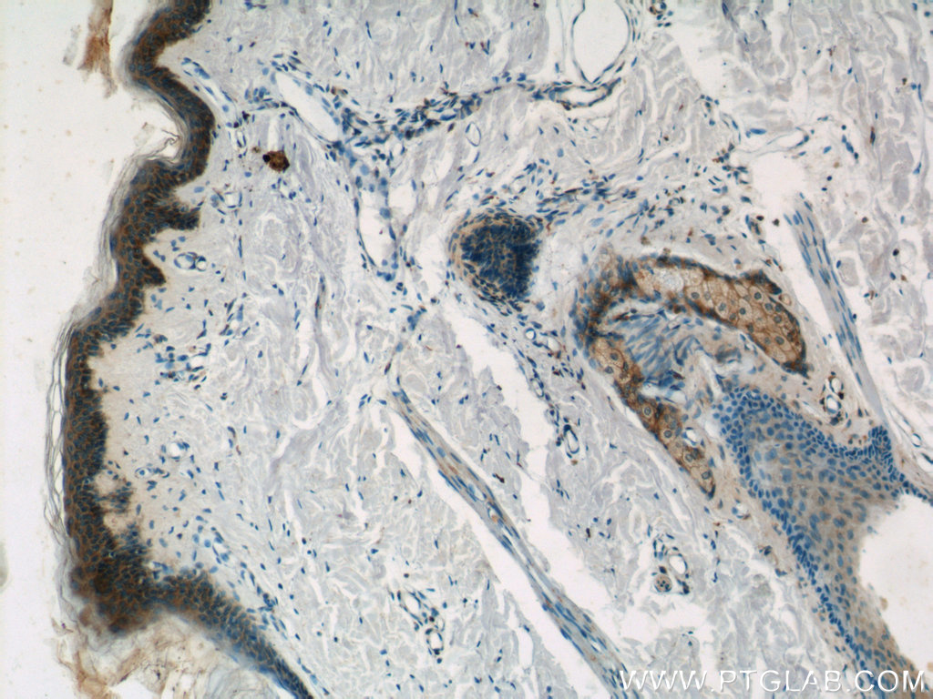 IHC staining of human skin using 21134-1-AP