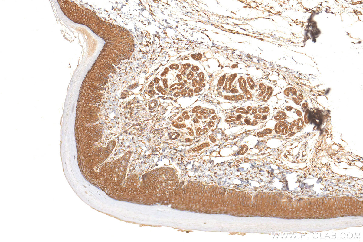 IHC staining of mouse skin using 21134-1-AP