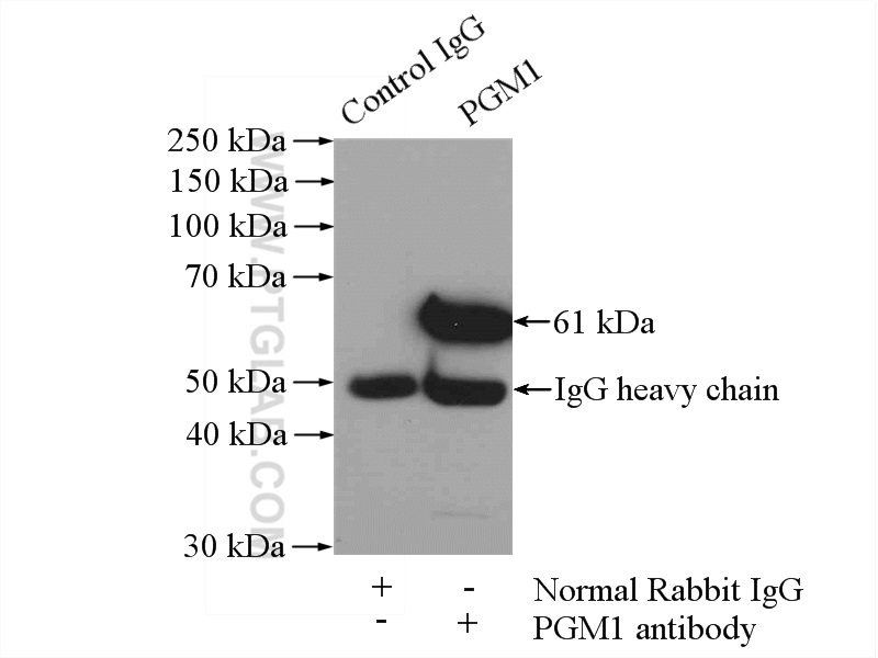 IP experiment of mouse skin using 15161-1-AP