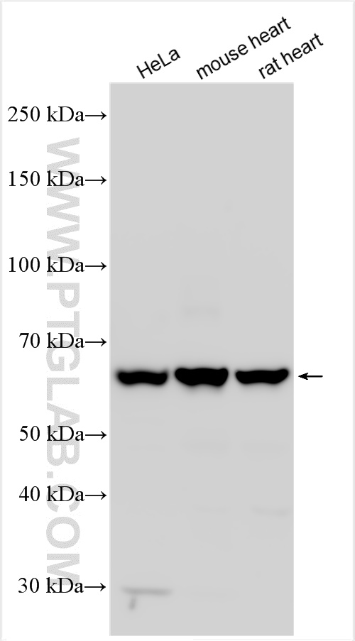 WB analysis using 15161-1-AP