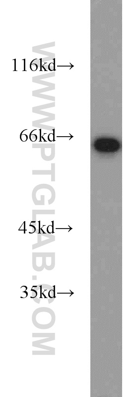 PGM1 Polyclonal antibody