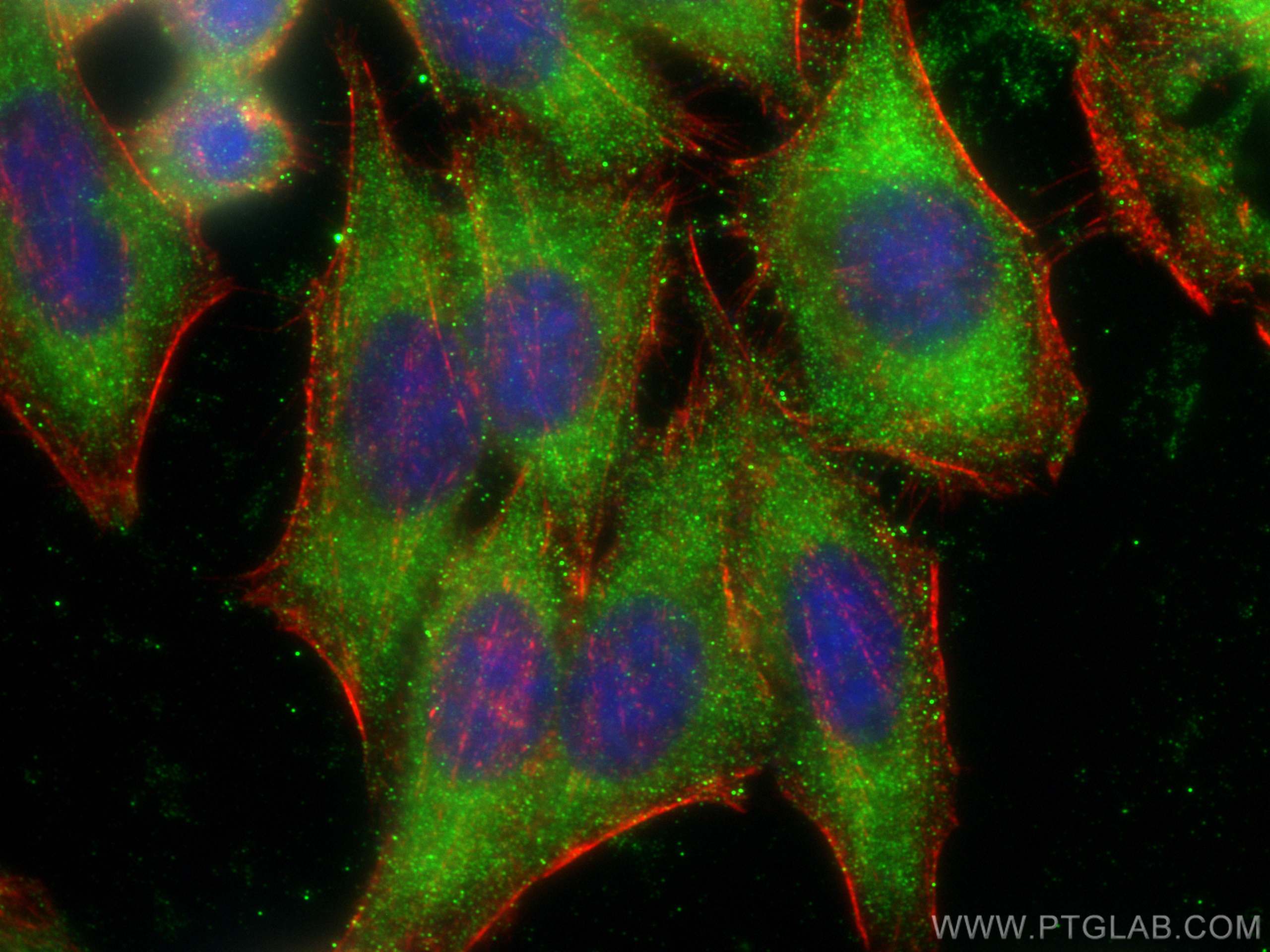 IF Staining of HepG2 using 66105-1-Ig (same clone as 66105-1-PBS)