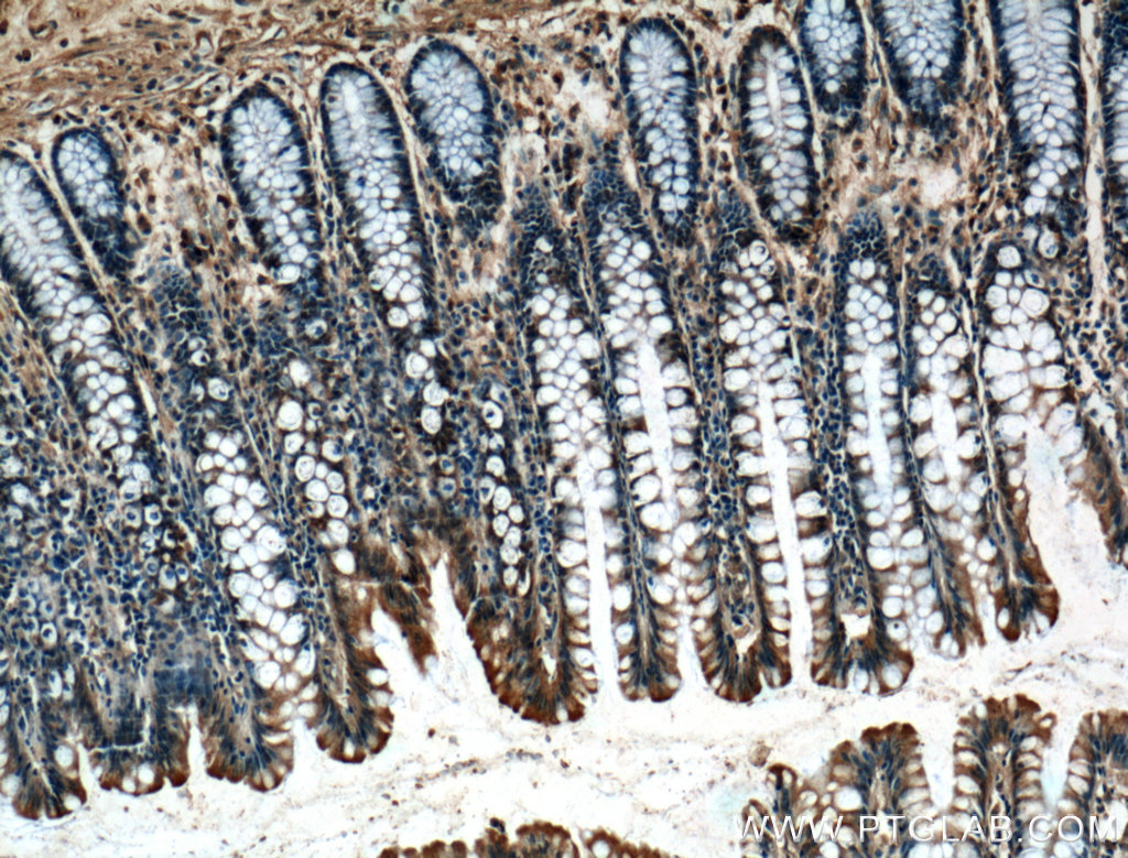 IHC staining of human colon using 66105-1-Ig (same clone as 66105-1-PBS)