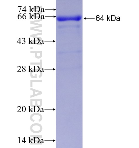 PGM2 fusion protein Ag1488 SDS-PAGE