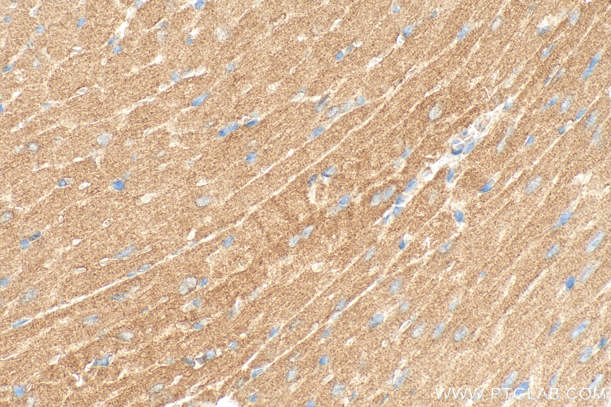 Immunohistochemical analysis of paraffin-embedded mouse heart tissue slide using 25081-1-AP (PGP antibody) at dilution of 1:400 (under 40x lens). Heat mediated antigen retrieval with Tris-EDTA buffer (pH 9.0). IHC staining of mouse heart using 25081-1-AP