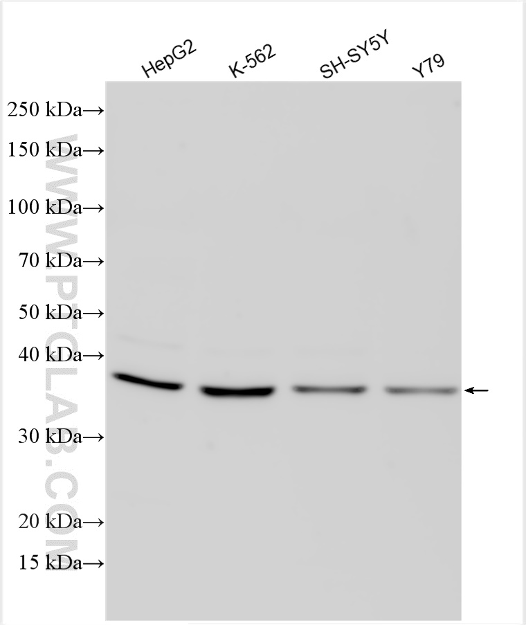 WB analysis using 25081-1-AP