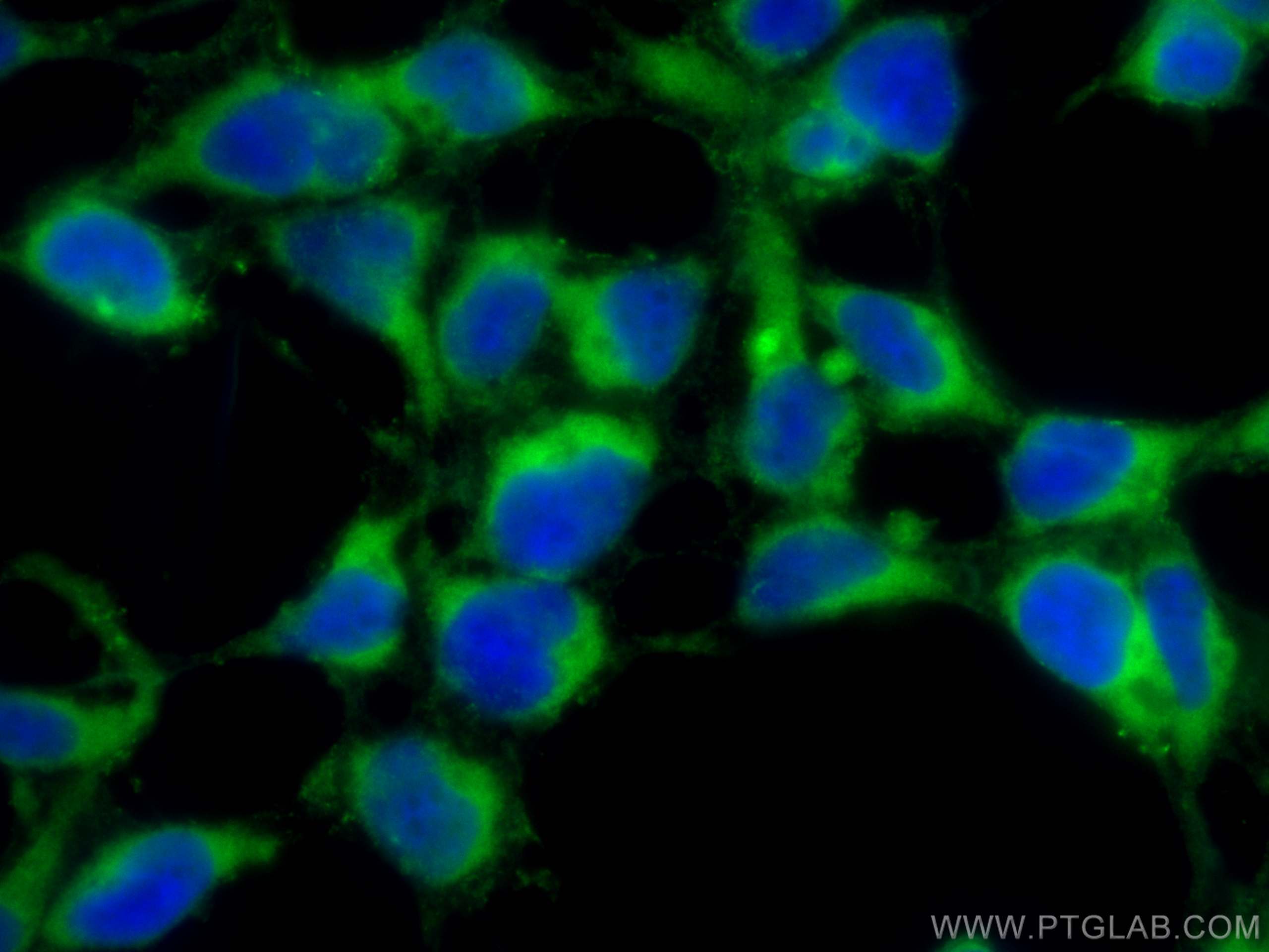 IF Staining of HEK-293 using 12990-1-AP
