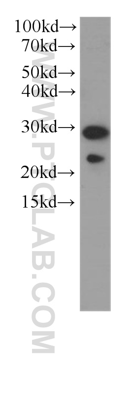 PGRMC2