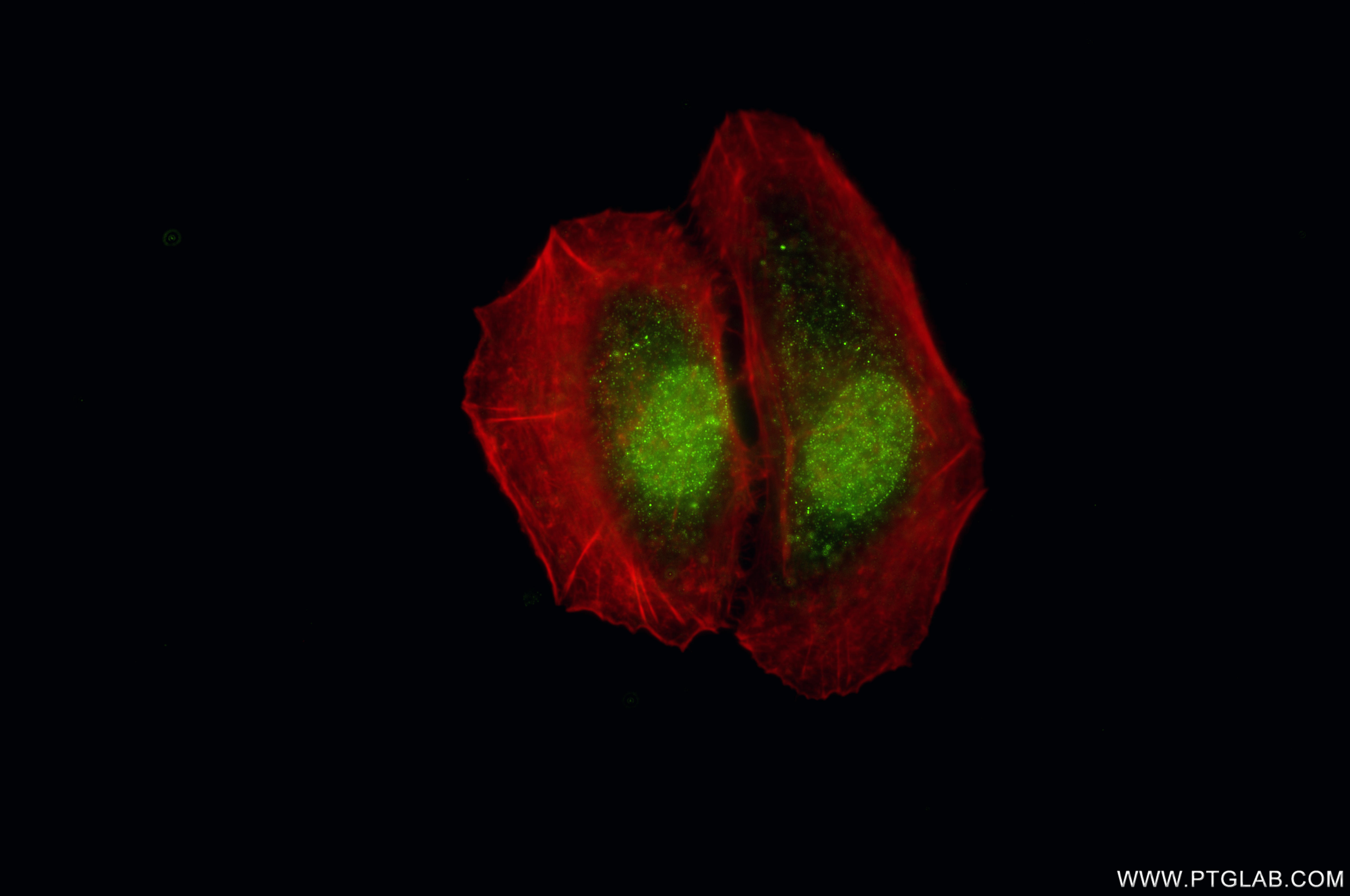 Immunofluorescent analysis of (4% PFA) fixed HeLa cells using PGRMC2 antibody (<a class='green' href='/productredirect?CatalogNo=86835-1-RR' target='_blank'>86835-1-RR</a>, Clone: 251819A8 ) at dilution of 1:500 and CoraLite®488-Conjugated Goat Anti-Rabbit IgG(H+L) (<a class='green' href='/productredirect?CatalogNo=SA00013-2' target='_blank'>SA00013-2</a>), CL594-Phalloidin (red). This data was developed using the same antibody clone with 86835-1-PBS in a different storage buffer formulation. IF Staining of HeLa using 86835-1-RR (same clone as 86835-1-PBS)