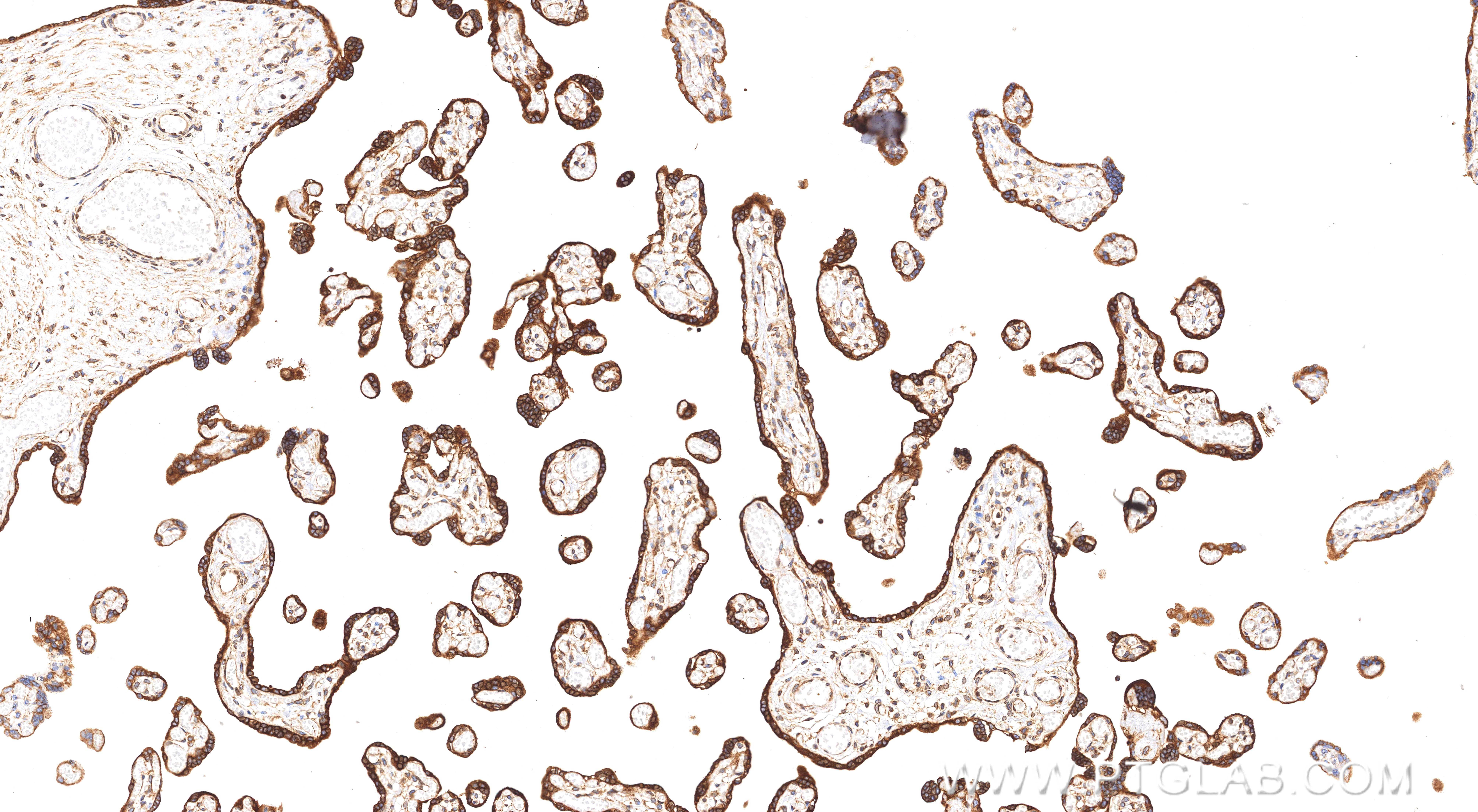 Immunohistochemical analysis of paraffin-embedded human placenta tissue slide using <a class='green' href='/productredirect?CatalogNo=86835-1-RR' target='_blank'>86835-1-RR</a> (PGRMC2 antibody) at dilution of 1:5000 (under 10x lens). Heat mediated antigen retrieval with Tris-EDTA buffer (pH 9.0). This data was developed using the same antibody clone with 86835-1-PBS in a different storage buffer formulation. IHC staining of human placenta using 86835-1-RR (same clone as 86835-1-PBS)