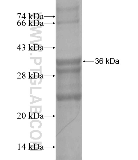 PGRMC2 fusion protein Ag20066 SDS-PAGE PGRMC2 fusion protein Ag20066 SDS-PAGE
