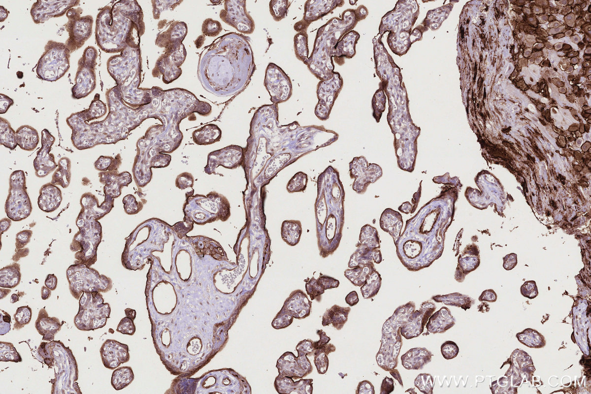 IHC staining of human placenta using 83302-1-RR IHC staining of human placenta using 83302-1-RR