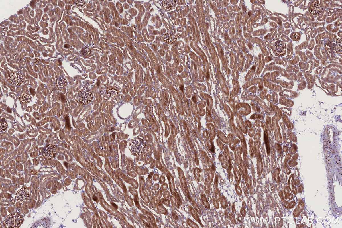 IHC staining of mouse kidney using 83302-1-RR IHC staining of mouse kidney using 83302-1-RR