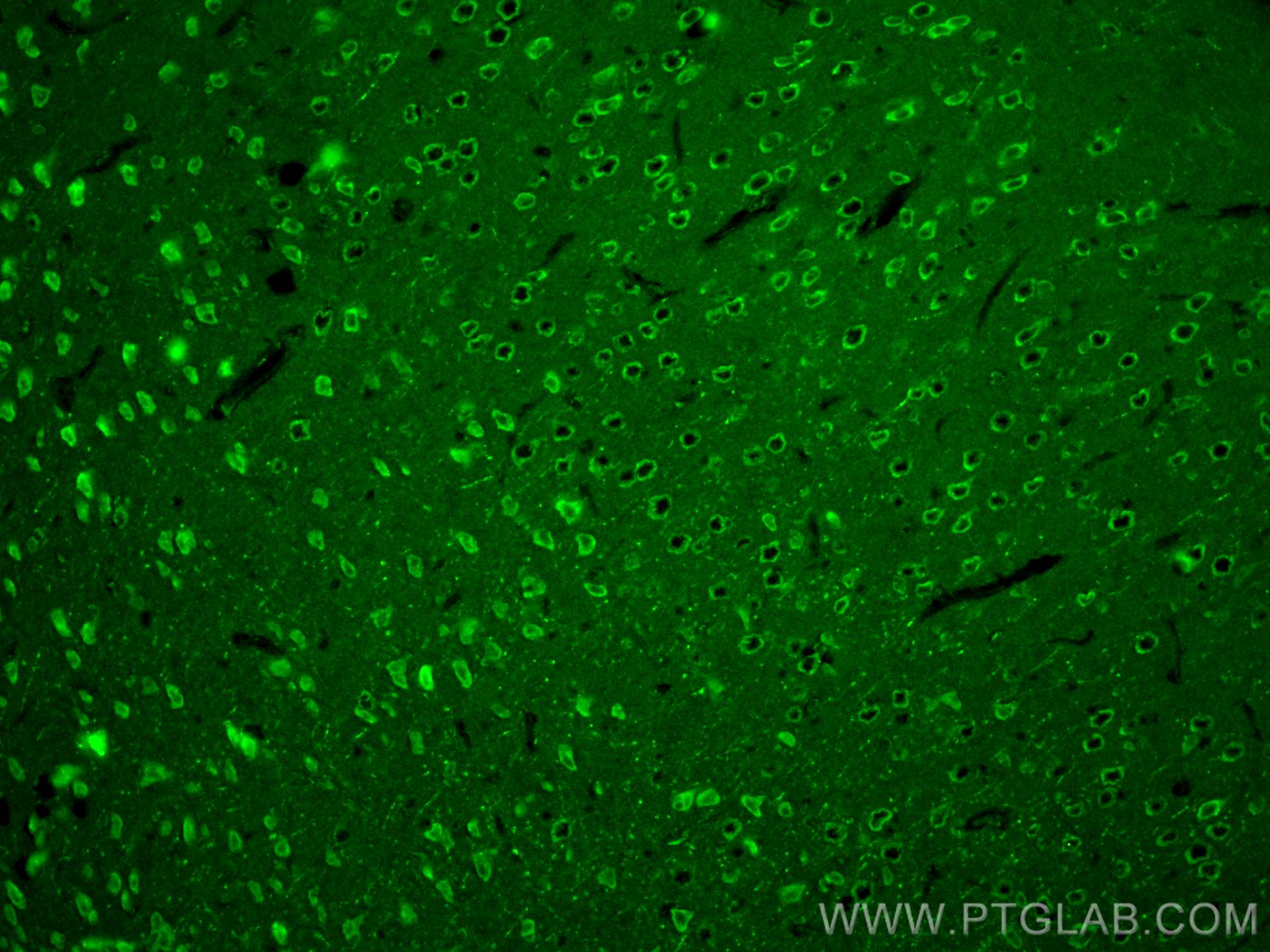 IF Staining of mouse brain using 23446-1-AP