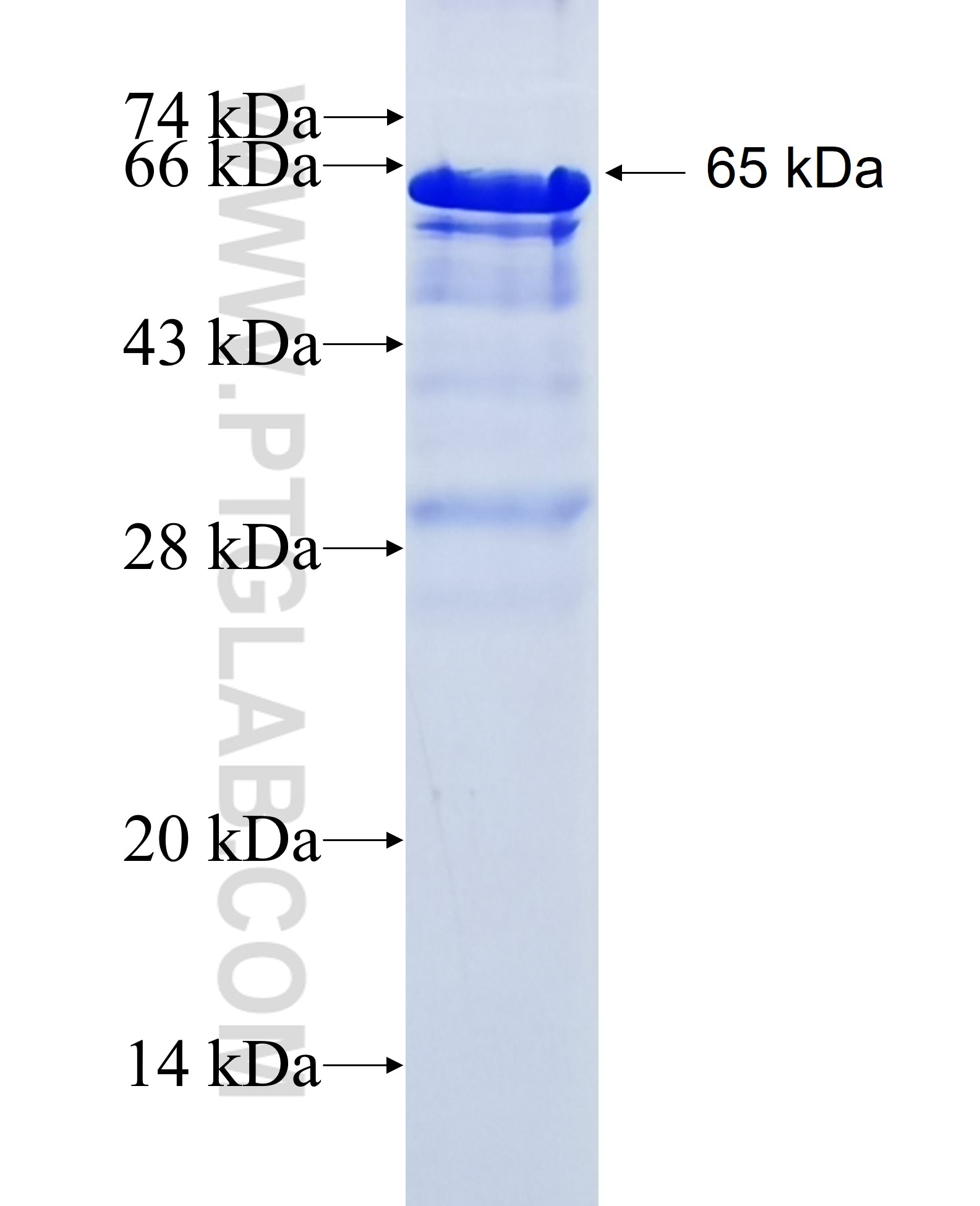 PHACTR1 fusion protein Ag20125 SDS-PAGE