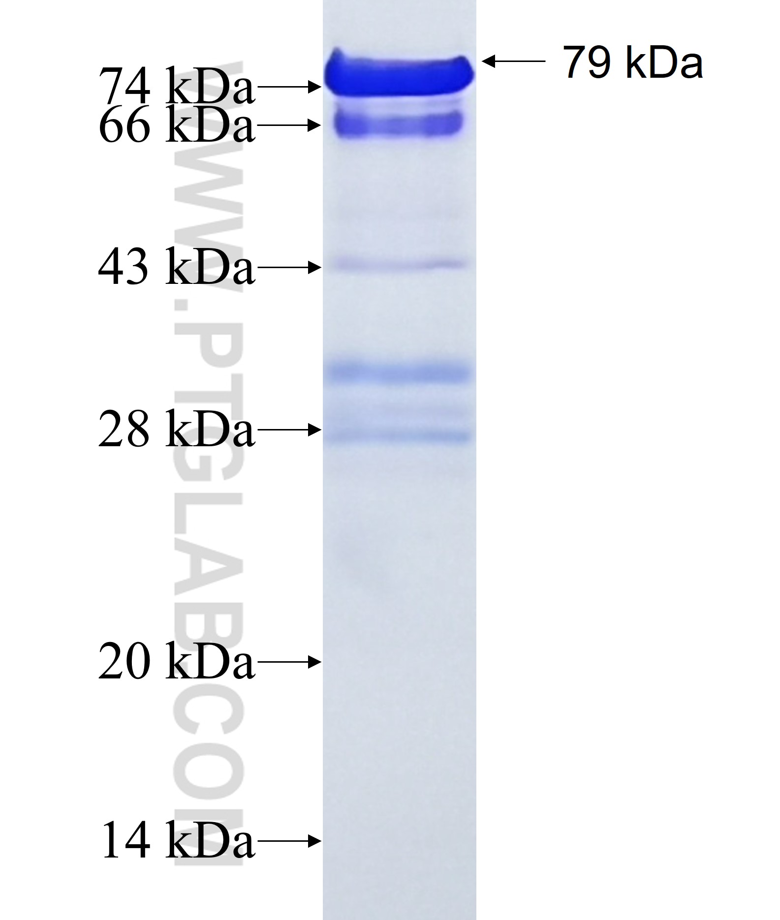 PHACTR2 fusion protein Ag18610 SDS-PAGE PHACTR2 fusion protein Ag18610 SDS-PAGE