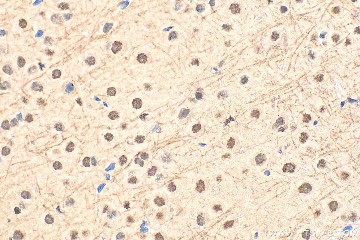 IHC staining of mouse brain using 18107-1-AP