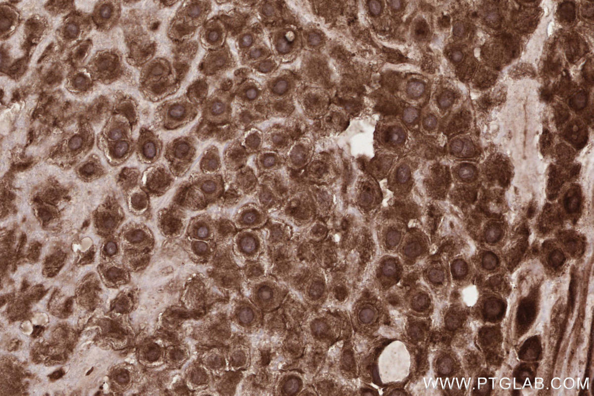 IHC staining of human placenta using 13408-1-AP IHC staining of human placenta using 13408-1-AP
