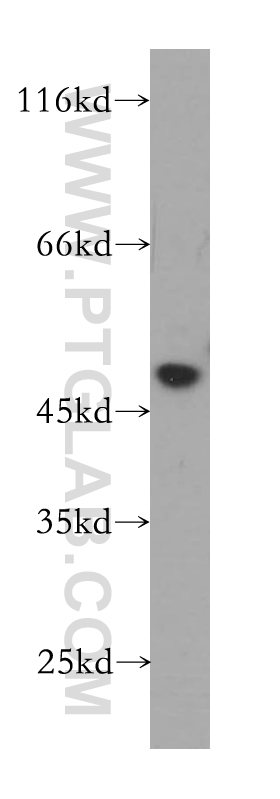 WB analysis of HeLa using 16481-1-AP