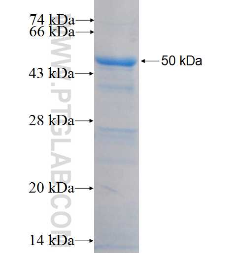 PHAX fusion protein Ag9047 SDS-PAGE PHAX fusion protein Ag9047 SDS-PAGE