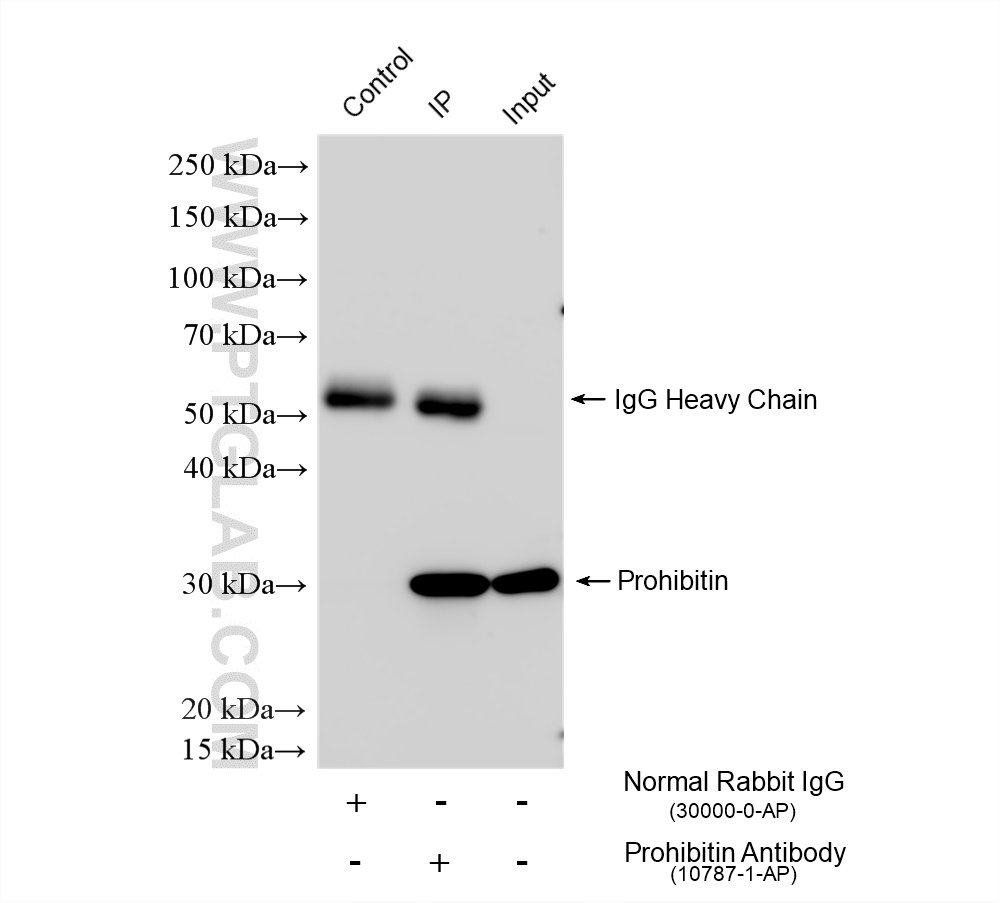 IP experiment of A431 using 10787-1-AP