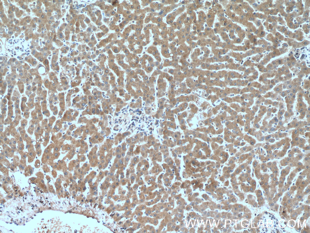 IHC staining of human liver using 60092-1-Ig