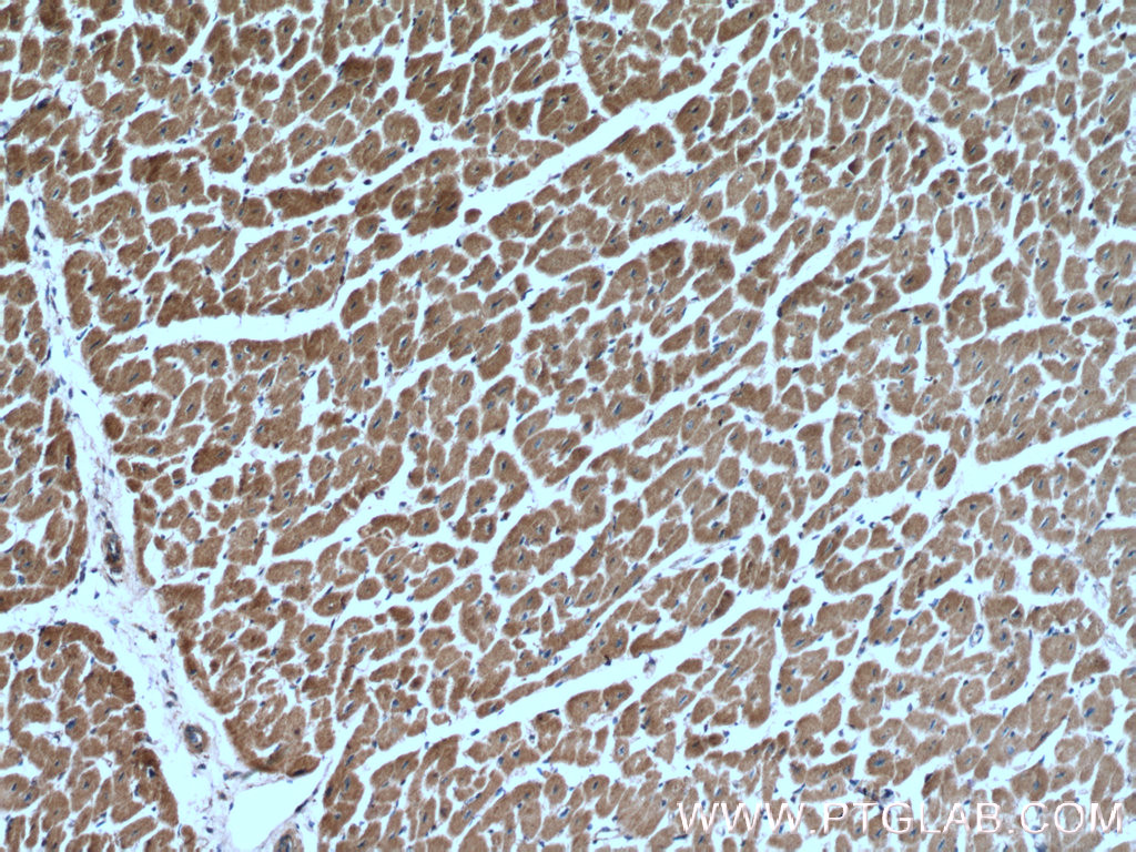 IHC staining of human heart using 12295-1-AP