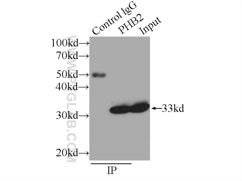 IP experiment of HeLa using 12295-1-AP