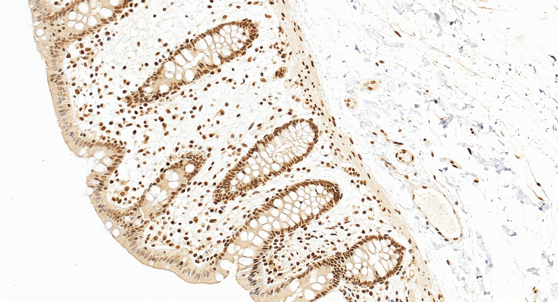 IHC staining of human colon using 12867-1-AP