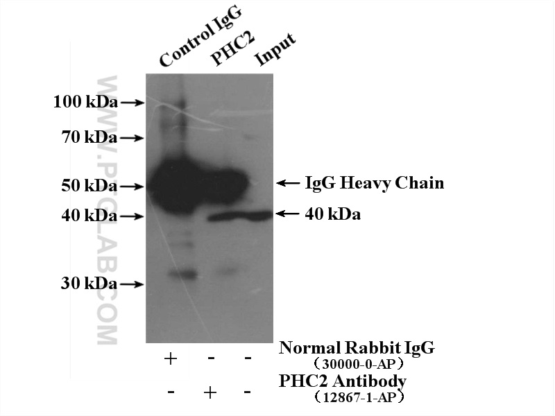 IP experiment of HL-60 using 12867-1-AP