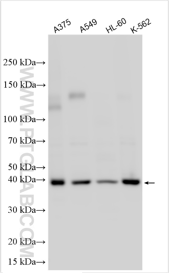 WB analysis using 12867-1-AP