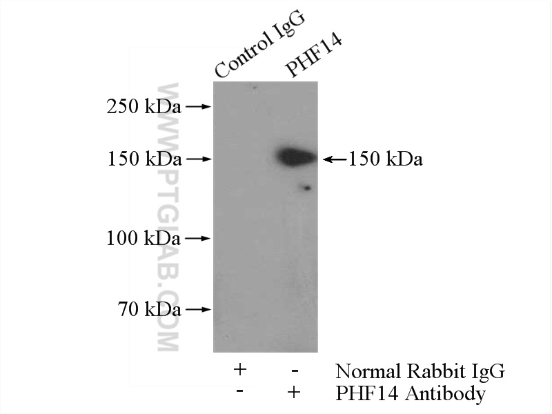 IP experiment of HEK-293 using 24787-1-AP