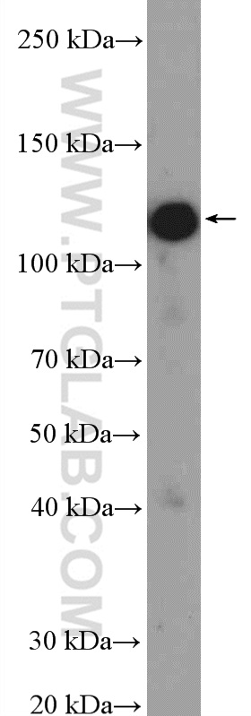 WB analysis of MDCK using 11513-1-AP