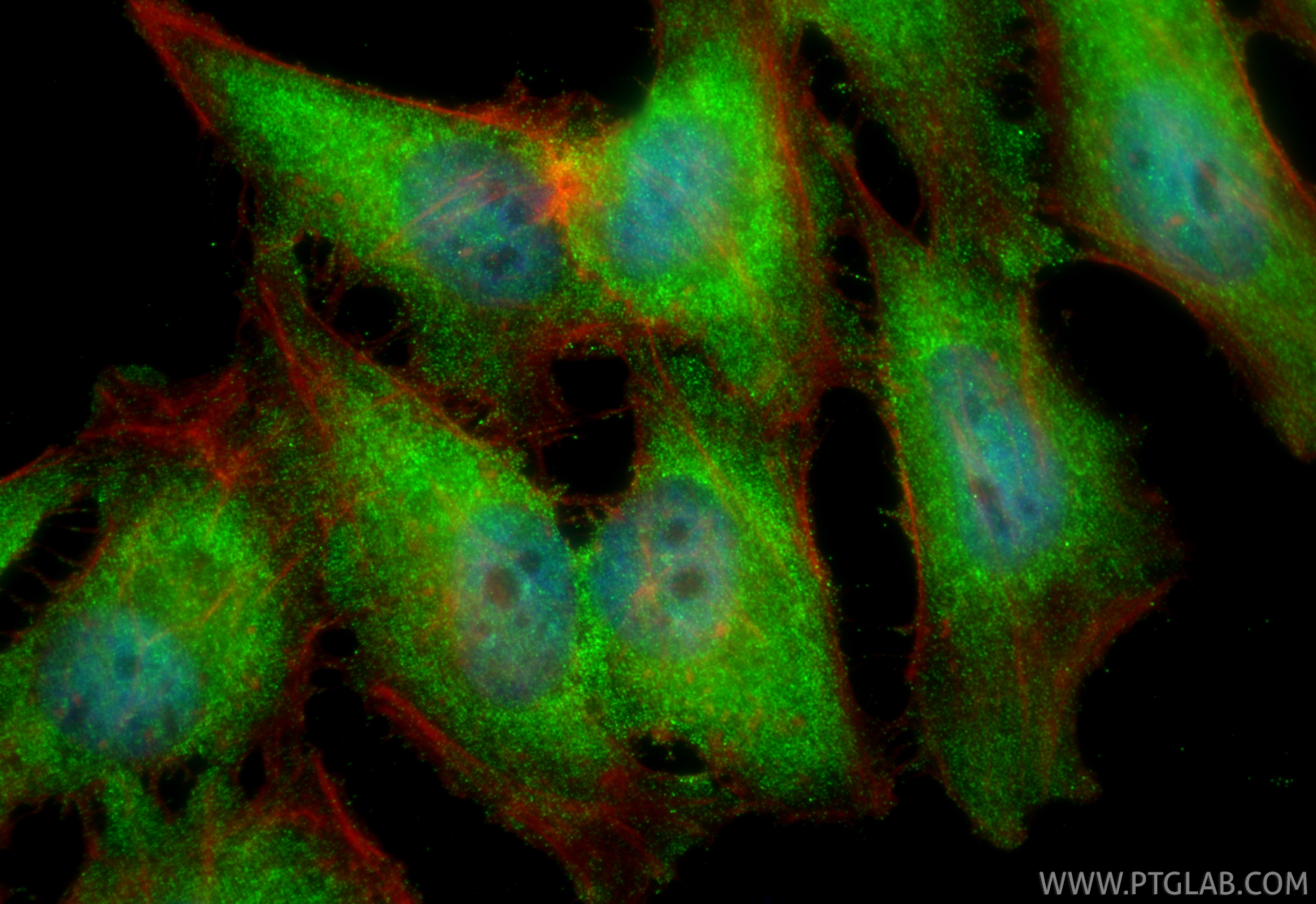 IF Staining of HeLa using 28472-1-AP (same clone as 28472-1-PBS)
