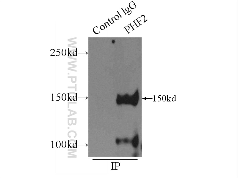 IP experiment of HeLa using 24624-1-AP