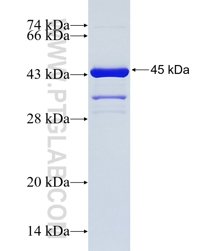 PHF20L1 fusion protein Ag25838 SDS-PAGE PHF20L1 fusion protein Ag25838 SDS-PAGE