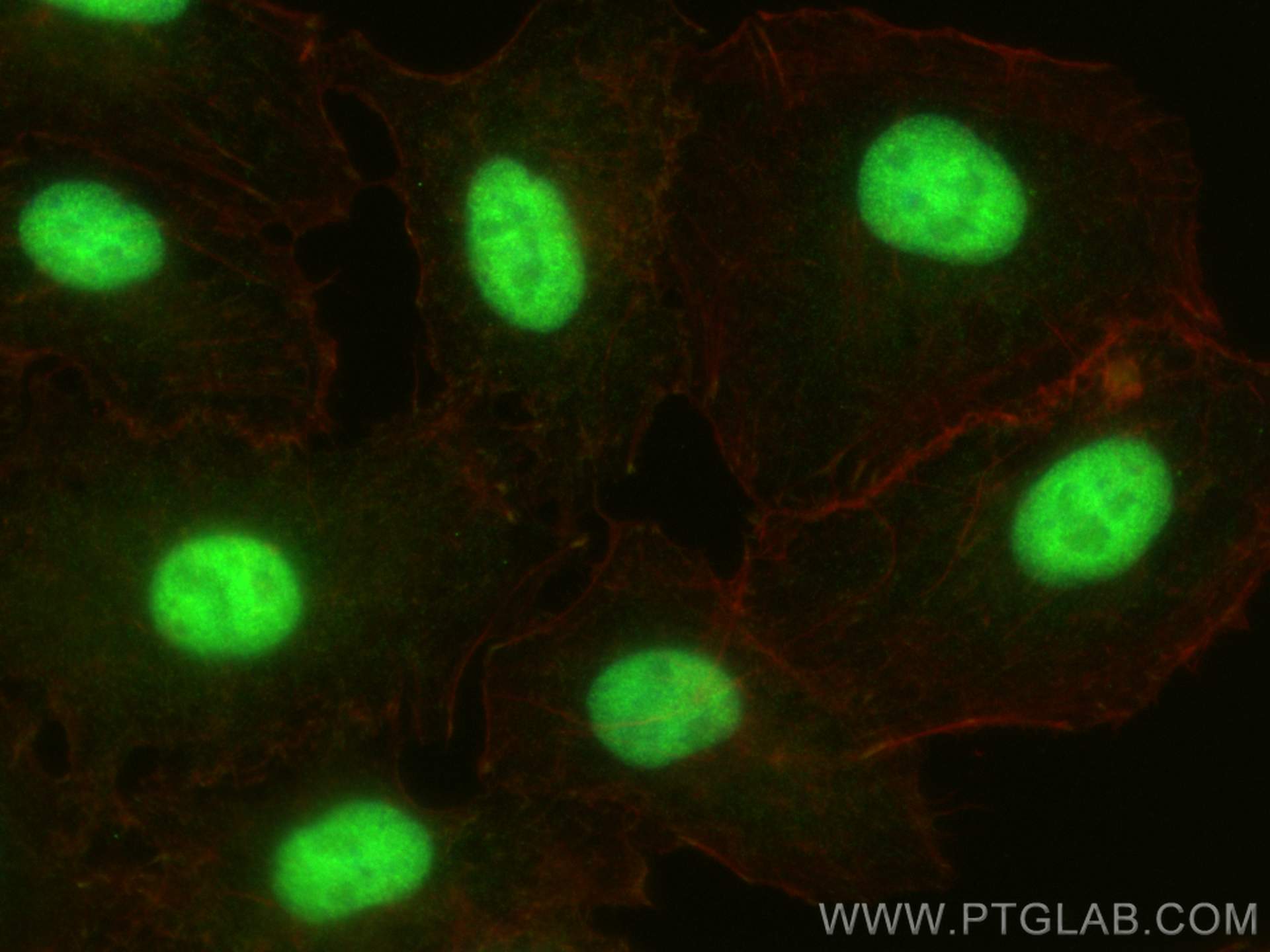 IF Staining of A549 using 25862-1-AP