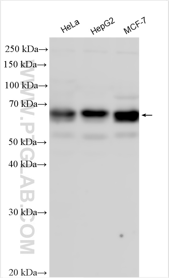 WB analysis using 25862-1-AP