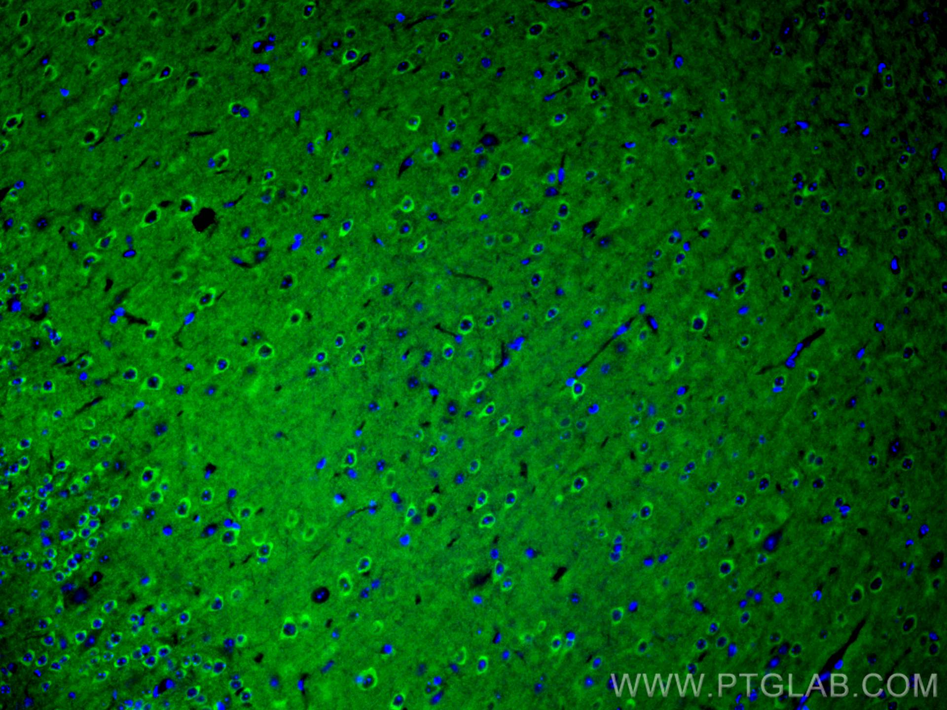 IF Staining of mouse brain using 27959-1-AP (same clone as 27959-1-PBS) IF Staining of mouse brain using 27959-1-AP (same clone as 27959-1-PBS)
