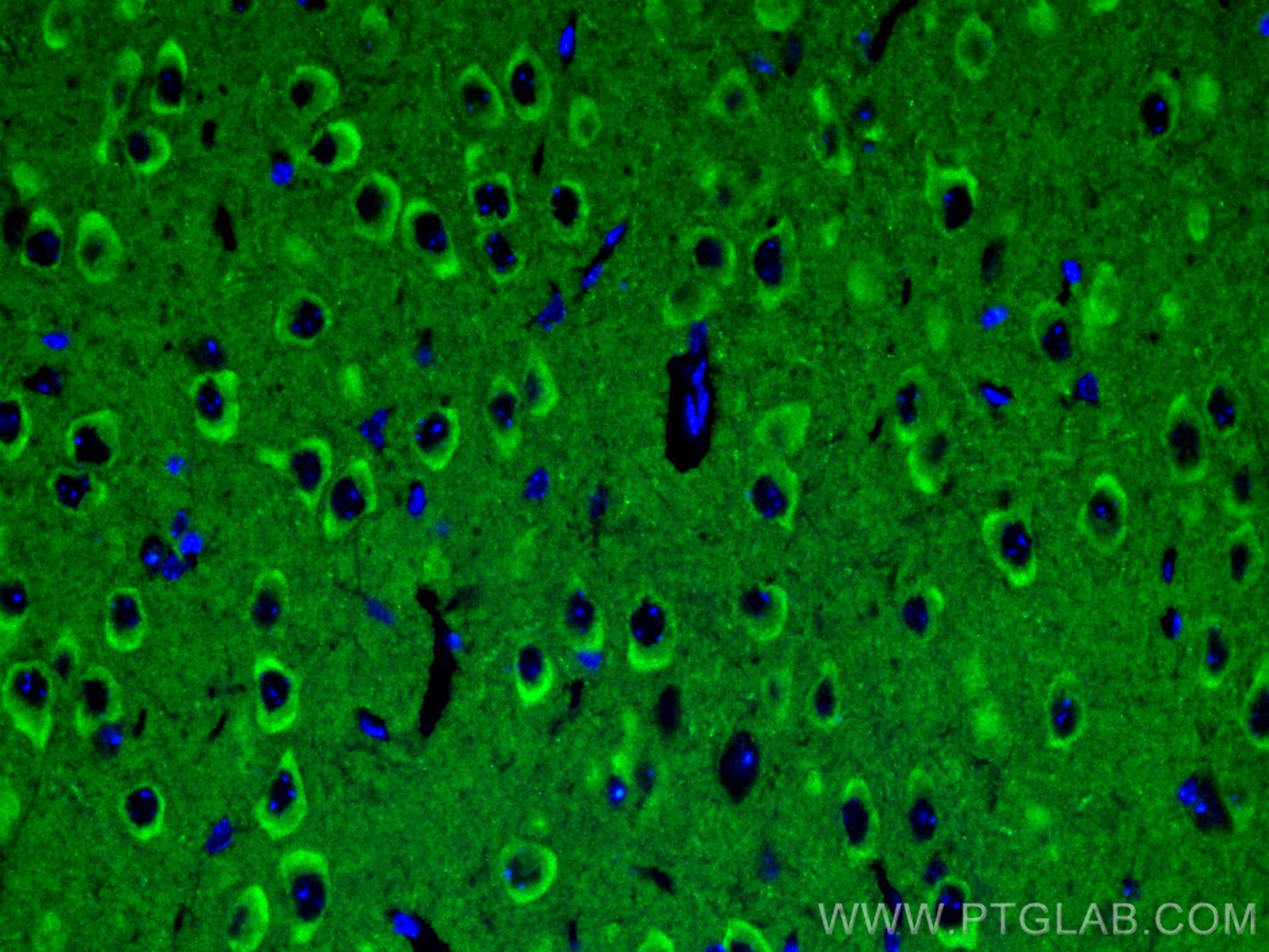 IF Staining of mouse brain using 27959-1-AP (same clone as 27959-1-PBS) IF Staining of mouse brain using 27959-1-AP (same clone as 27959-1-PBS)
