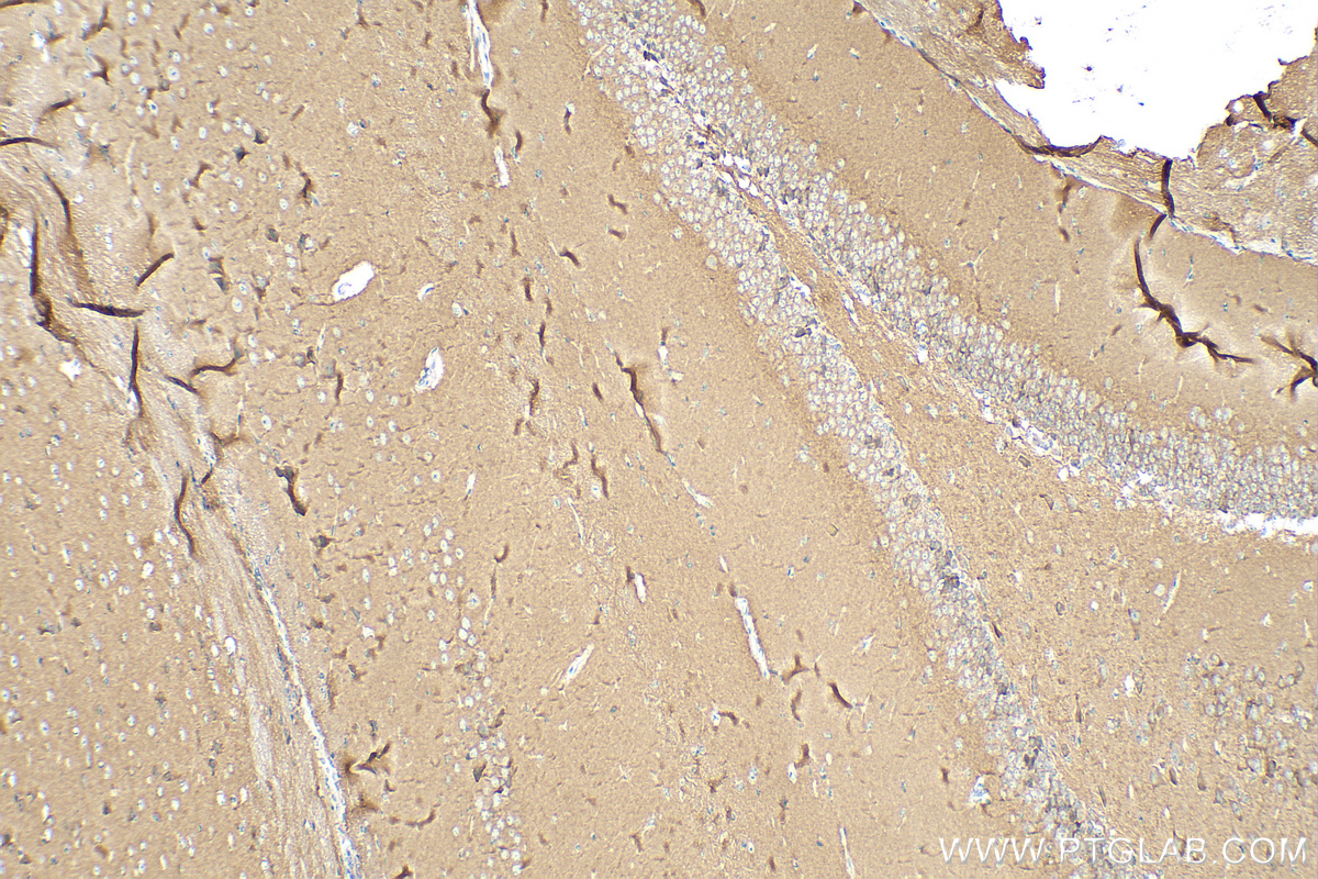 IHC staining of mouse brain using 27959-1-AP (same clone as 27959-1-PBS) IHC staining of mouse brain using 27959-1-AP (same clone as 27959-1-PBS)