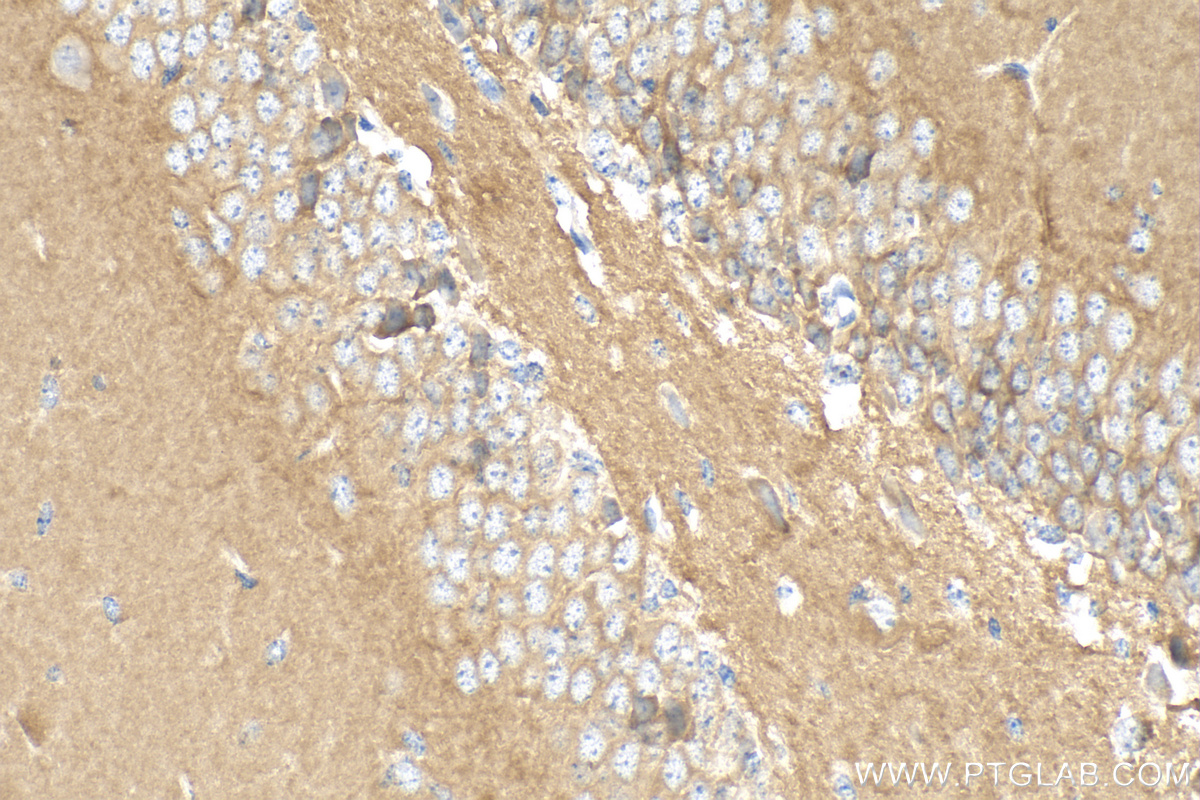 IHC staining of mouse brain using 27959-1-AP (same clone as 27959-1-PBS) IHC staining of mouse brain using 27959-1-AP (same clone as 27959-1-PBS)