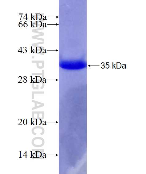 PHF24 fusion protein Ag27505 SDS-PAGE PHF24 fusion protein Ag27505 SDS-PAGE