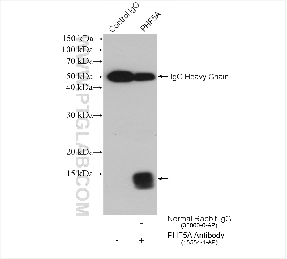 IP experiment of HeLa using 15554-1-AP